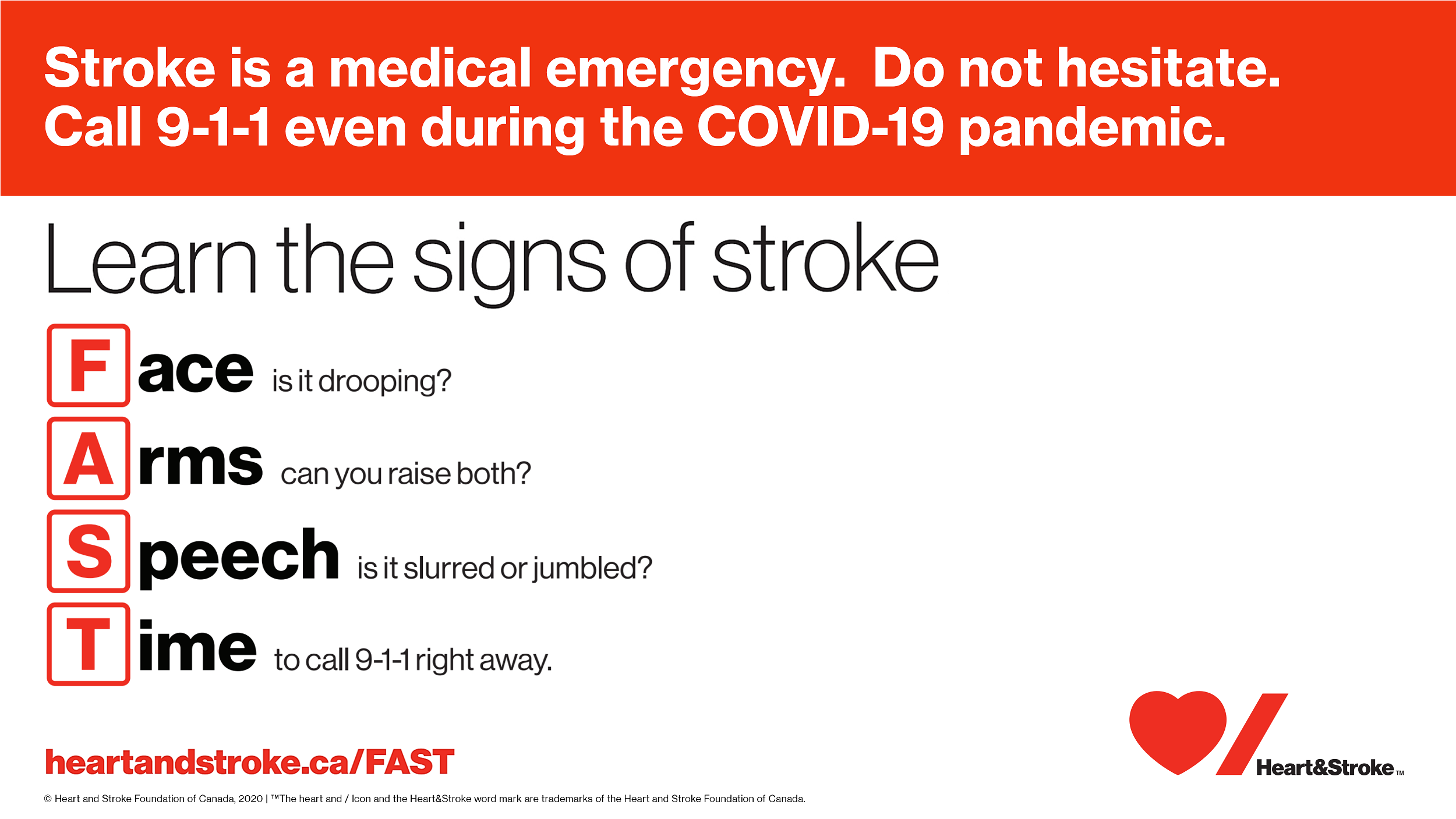Signs of Stroke: FAST (Face Arms Speech Time) - Call 911 even during COVID-19